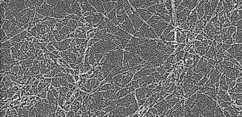 Nanocellulose fibers are some of the strongest, toughest materials known to man.